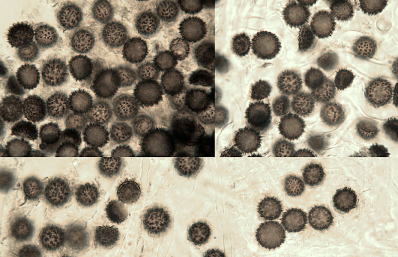 Scleroderma verrucosum spores